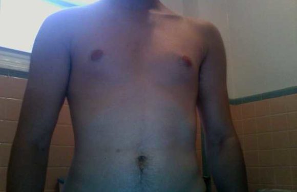 Losing Man Boobs – Is It That Easy?